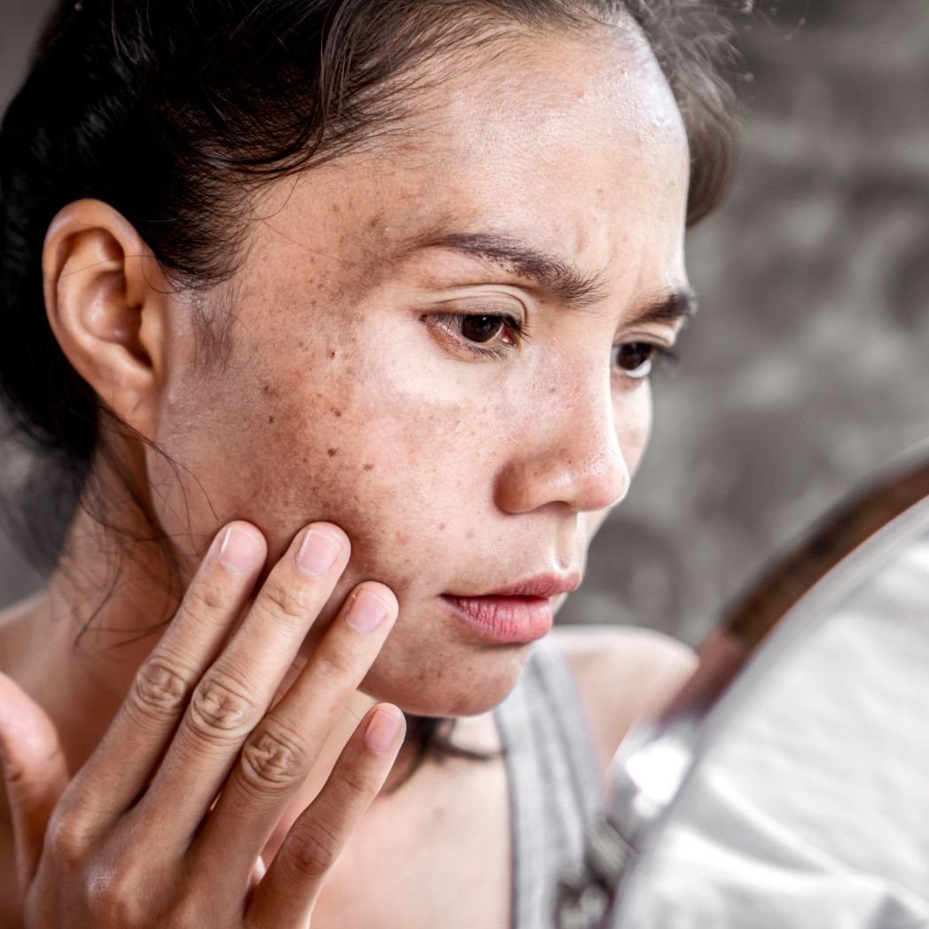 the women show her face masks due to Liver detox Skin Issues